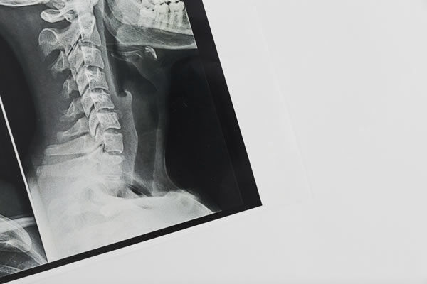 Radiology Medical Billing